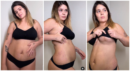 Meu quadril antes e depois da gravidez