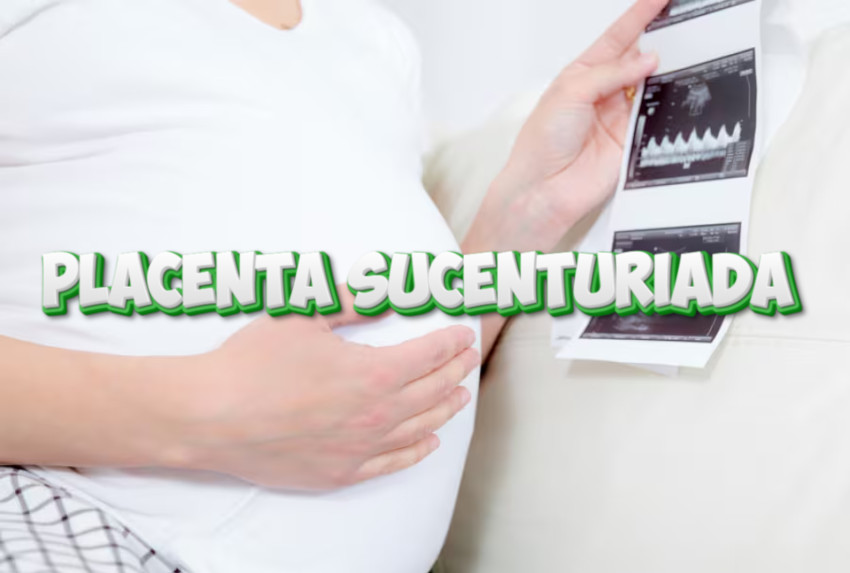 Placenta Sucenturiada: Compreendendo os Desafios e Cuidados Necessários na Gravidez